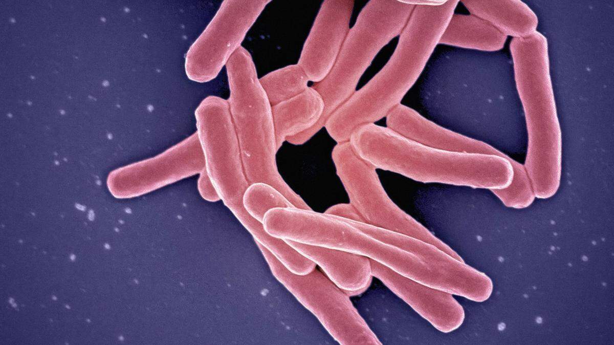 After being dormant in the body for years, Mycobacterium Tuberculosis can suddenly multiply and cause an active TB infection.
