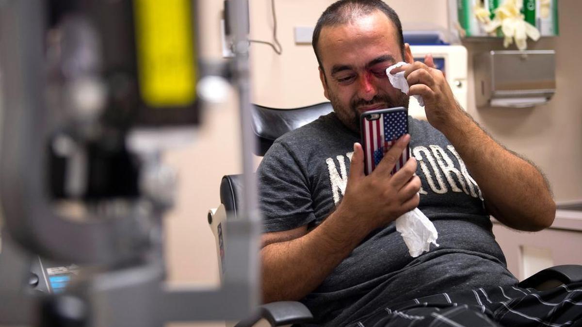 Using his American flag-covered mobile phone as a mirror, Faisal Razmal wipes his injured left eye after a follow-up exam in late September, when he learned he would not lose his eye but the sight in that eye would not return. A piece of shrapnel severed Razmal’s optic nerve, and doctors say the damage is permanent.
