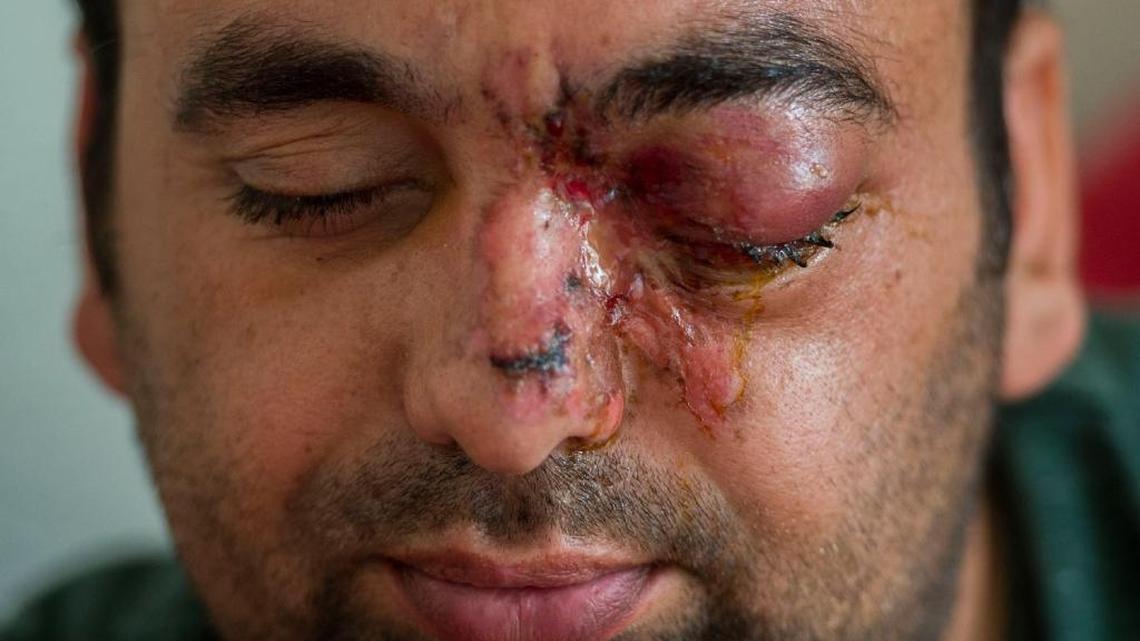 How you can help Sacramento’s Afghan refugees who served U.S. in war