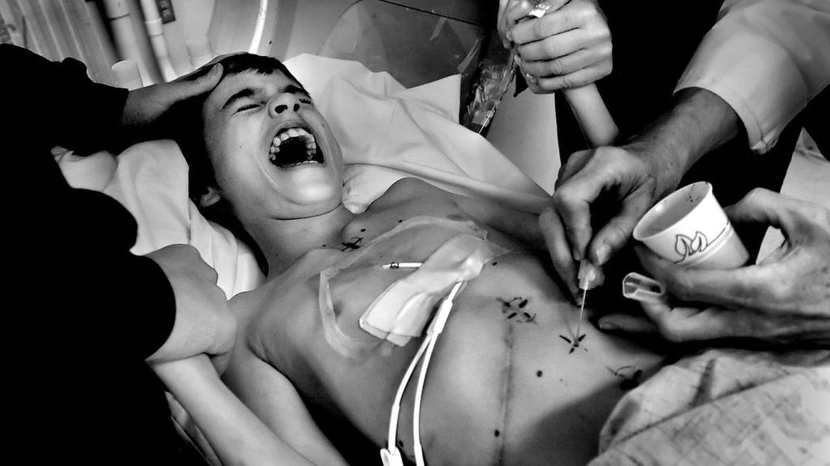 Derek Madsen, 11, is comforted by his brother Micah Moffe, 17, left, and mom Cyndie French , right, as he gets a tattoo in preparation for radiation therapy for cancer during an orientation in radiation on November 30, 2005 at UC Davis Medical Center. Micah often accompanies Derek to treatments even though his schoolwork suffers.
