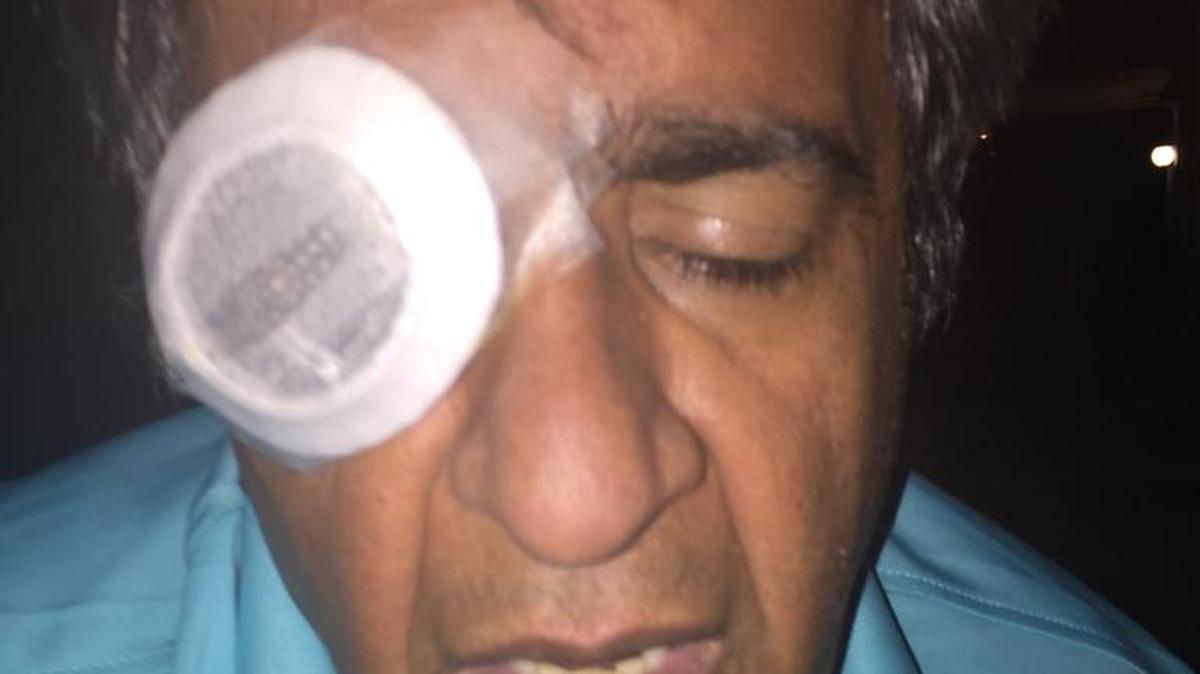 Ramin Shekarlab says he lost vision in his right eye after authorities at the Sacramento County Jail delayed providing surgery.