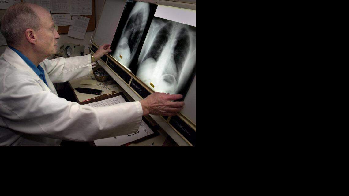 
Dr. Fred Stargardter, a radiologist checks over chest x-rays at the Sacramento County Primary Care Center on Stockton Blvd. 
