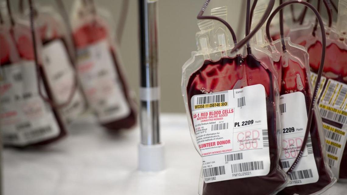 Bags of blood wait to have the excess air removed after the Leukoreduction process – the process of removing white cells from whole blood to prepare blood for transfusions. BloodSource announced it is merging operations with San Francisco-based Blood Centers of the Pacific and will be part of Blood Systems, a Scottsdale, Ariz.-based nonprofit organization.