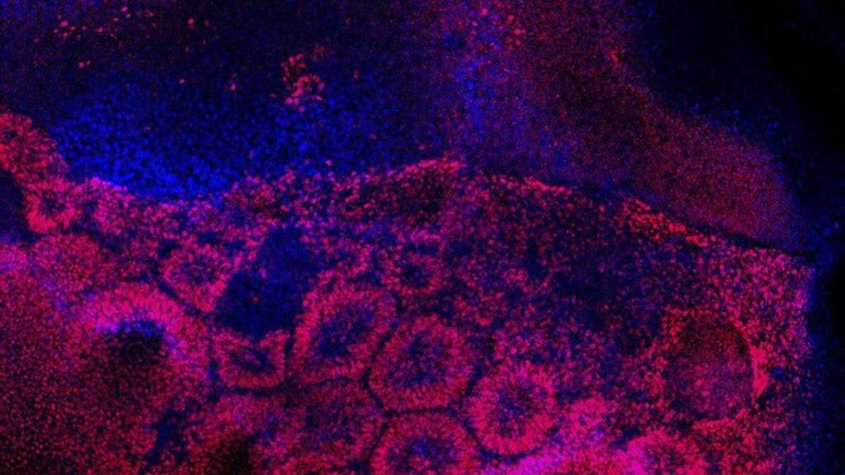 Retinal pigment epithelium precursor cells Human embryonic stem cells differentiating into precursors cells of the retina. Nuclei are in blue. Pink indicates the presence of Pax6, a protein found in retinal tissue. The retinal pigment epithelium is the tissue responsible for macular degeneration, the most common cause of blindness.