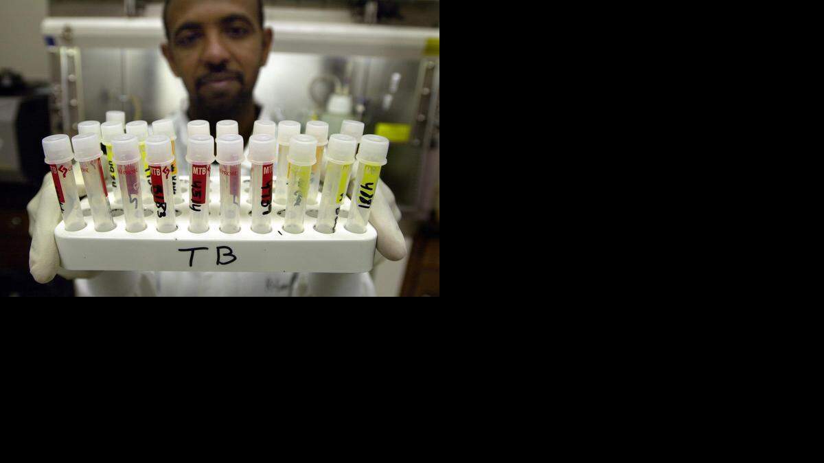 Sacramento County Public Health microbiologist Rifaat Solomon holds test tubes containing patient specimens believed to contain the tuberculosis bacteria.
