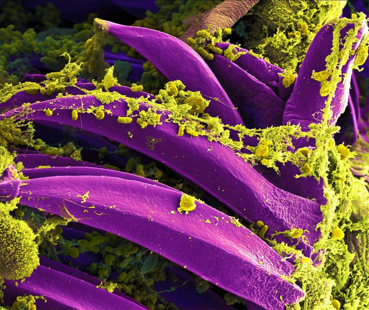 Microscopic photos shoe the Yersinia pestis bacterium, in yellow, which causes bubonic plague.