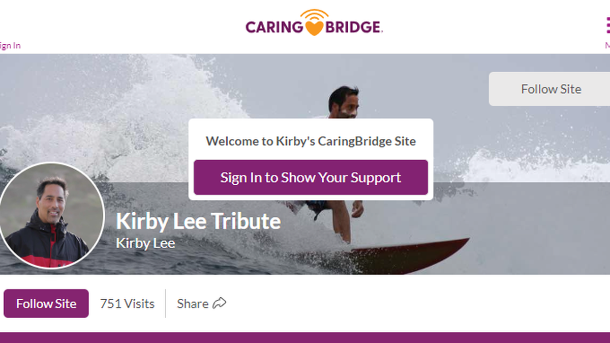 Kirby Lee, a beloved surfer and father, died days after a surfing accident in California.