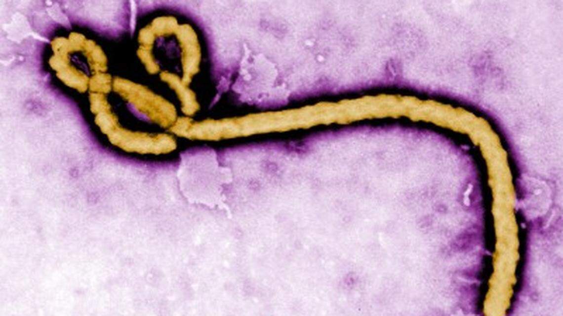‘Very significant pandemic’ feared in Africa as ebola spreads. What to know