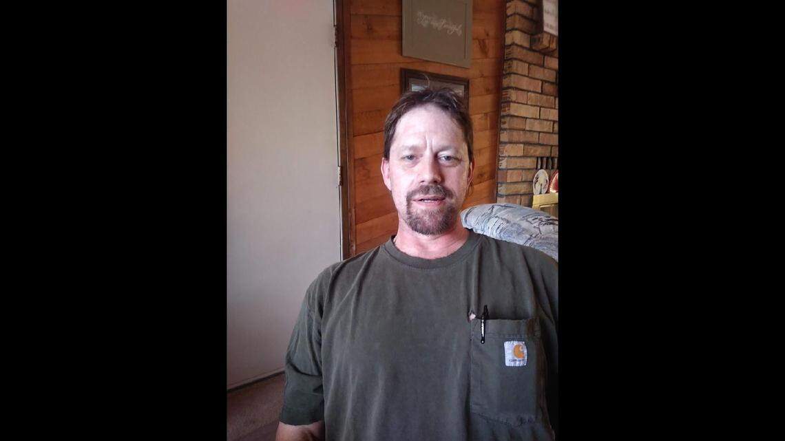 John Murdoch was awake when “a surgical fire combusted” and burned his face during a procedure at an Oregon hospital, a lawsuit says.