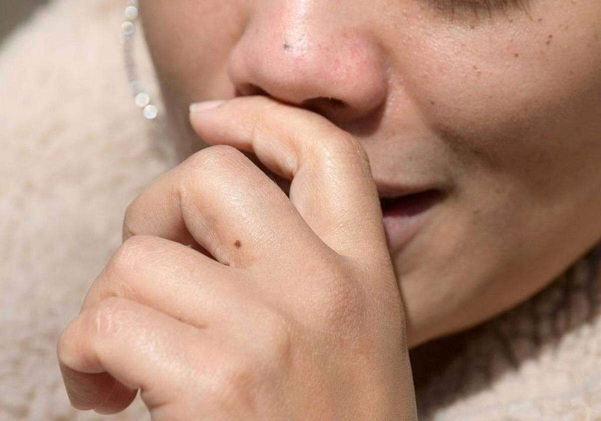 (FILES) This file photo taken on March 22, 2021, shows a person rubbing their nose in New York City. - Chilly weather and common respiratory infections often go hand in hand. Reasons for this include people gather inside more in winter, and viruses survive better in low humidity indoor air. But there has been less certainty about whether lower temperatures actually impair human immunity, and if so, how. Now, a new study published on December 6, 2022, in The Journal of Allergy and Clinical Immunology details a previously unknown way that the immune system attacks viral intruders inside the nose -- and finds it works better when it's warm. (Photo by Angela Weiss / AFP) (Photo by ANGELA WEISS/AFP via Getty Images)