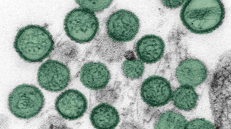Outbreak kills 3 on cruise ship. What to know about hantavirus in California
