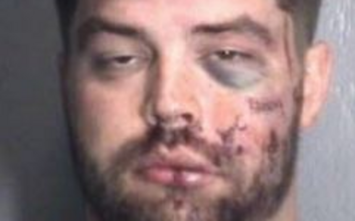 John Alexander Bracken, 28, faces charges of burglary and injury to real and personal property after Carolina Beach, N.C., police found him beaten on the front lawn of a home he allegedly tried to burglarize.