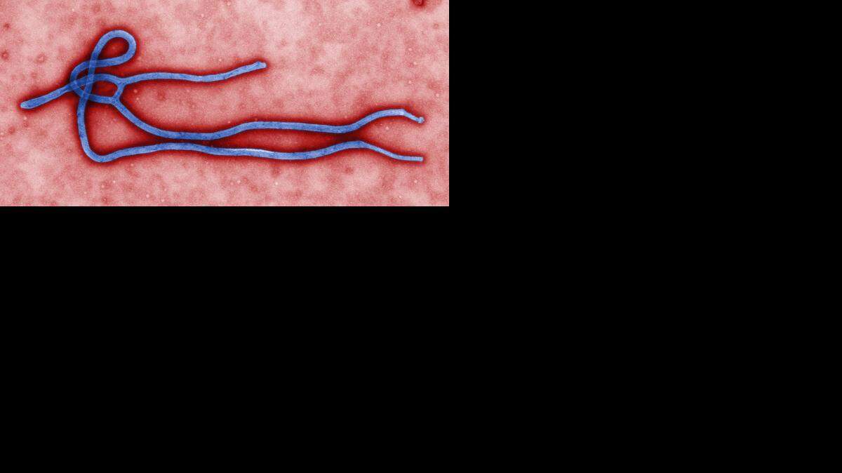 
The Ebola virus. 
