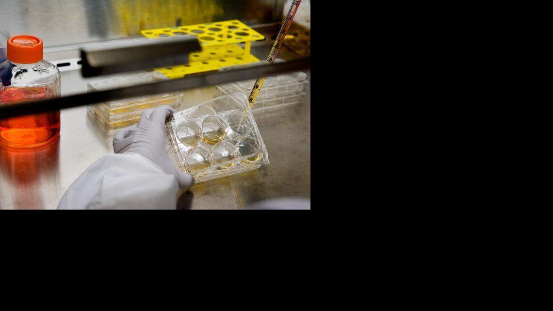 
The California Institute for Regenerative Medicine expects to be taking part in 10 early-stage clinical trials this year, an achievement that it points to with pride; however, no California-financed cures or therapies have reached the clinic and none are likely to do so for years. 
