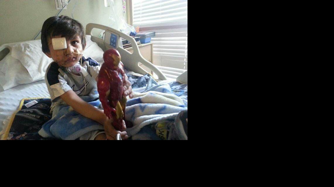 
 Four-year-old Kevin Vicente is shown in February after he was mauled by a pit bull in Arizona. Doctors said then that the attack had left the boy unable to swallow properly or open one eye. They said Kevin faced months, if not years, of reconstructive surgery.
