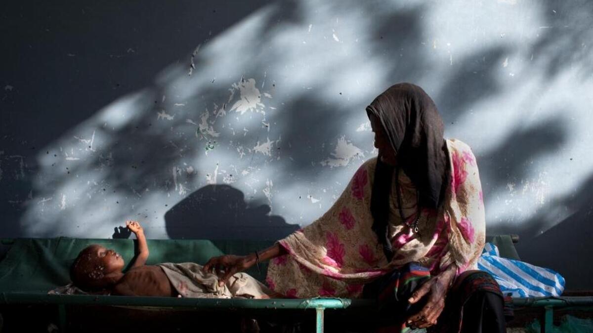 A woman sits next to a child suffering from malnutrition at a hospital in the Somali capital of Mogadishu.