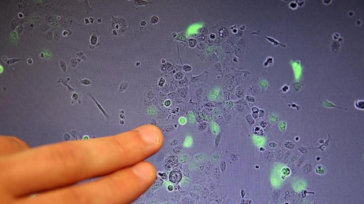 A screen displays the view from a microscope as T cells with receptors attack cancer cells.